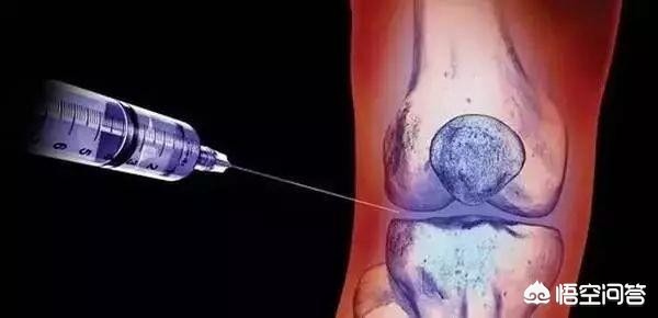 膝关节痛上下楼梯痛教你一招缓解,走平路时膝关节疼痛是什么原因