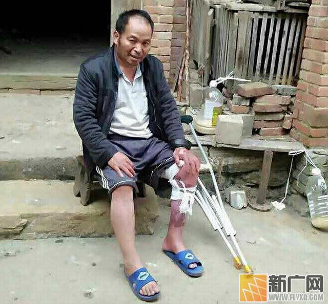 彝族村民李增贵烤贾酒盼脱贫遇火灾,栽多少包谷才能抚平49%烧伤