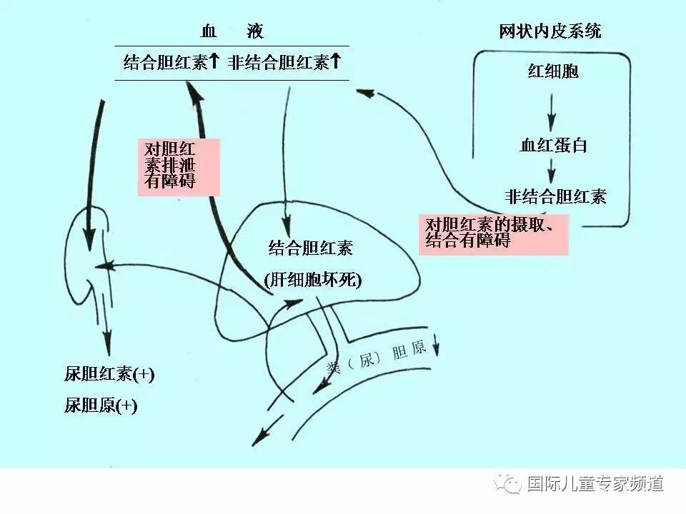 「PPT干货」国际儿童专家频道学术讲座.NO7——浙江大学医学院附属儿童医院消化科，陈洁主任主讲《婴儿胆汁淤积性肝病的诊治》