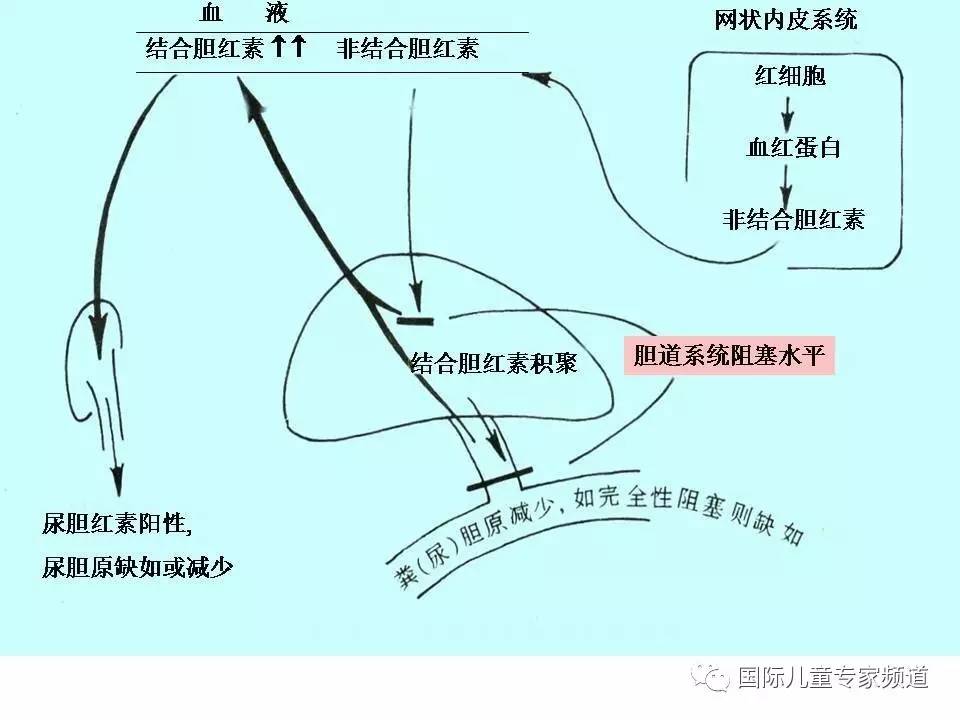 「PPT干货」国际儿童专家频道学术讲座.NO7——浙江大学医学院附属儿童医院消化科，陈洁主任主讲《婴儿胆汁淤积性肝病的诊治》
