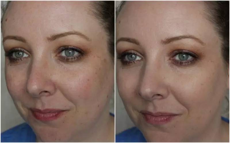 八一八年代的护肤品,八一八欧莱雅品牌