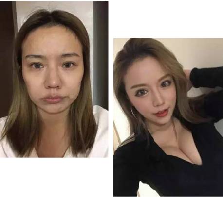 人工美胜过自然美,自然美才是真的美不要去整容