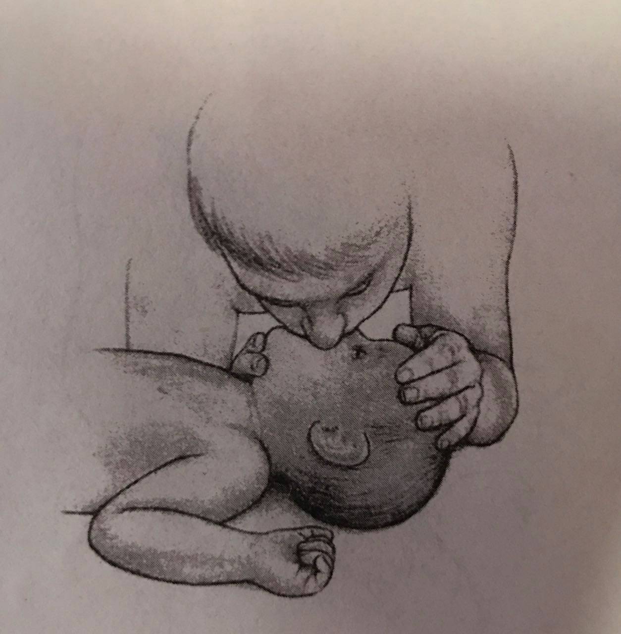 宝宝摔倒磕到头肿起来软软的,宝宝摔倒磕到后脑勺观察多久