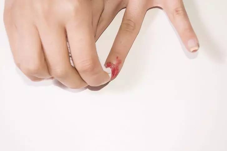 指甲从根部断裂去除断甲,指甲断裂在家自己怎么修补