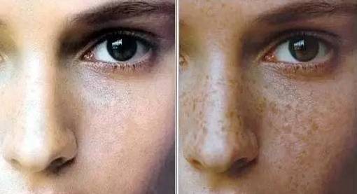 那些被阳光选为“斑”长的肌肤，得学会这样自救