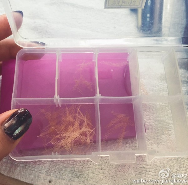 双眼皮100种整形图解,双眼皮整形全程讲解