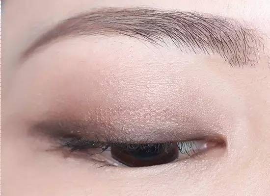 双眼皮100种整形图解,双眼皮整形全程讲解