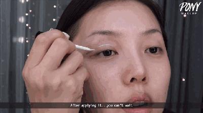 双眼皮100种整形图解,双眼皮整形全程讲解