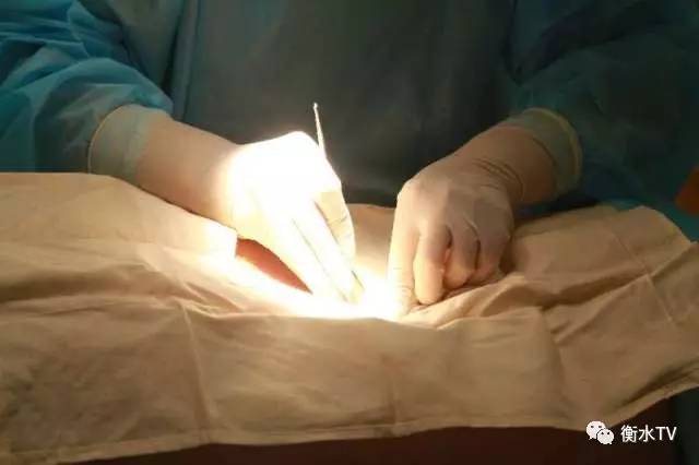 左常波针灸治颈肩腰腿疼针法,颈肩腰腿疼点穴止疼秒杀绝技