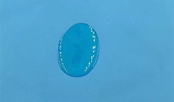 祛痘神器痘痘的克星,和痘痘疯狂抗争的经历