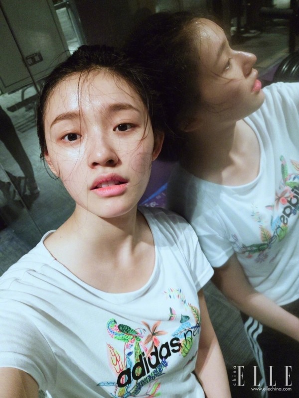 双眼皮100种整形图解,双眼皮整形全程讲解