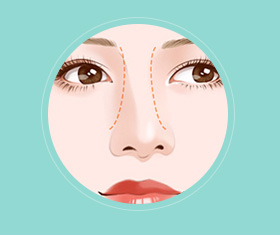 蒜头鼻鼻基底凹陷嘴凸,蒜头鼻和鹰钩鼻图片