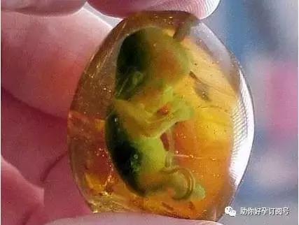 羊水是婴儿细胞还是母体细胞,羊水是胎儿的基因吗