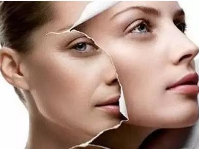 跟着皮肤科专家学习皮肤综合管理方法从此去美容院的钱都省了