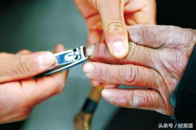 女子手撕倒刺后续,女子手撕倒刺进了医院