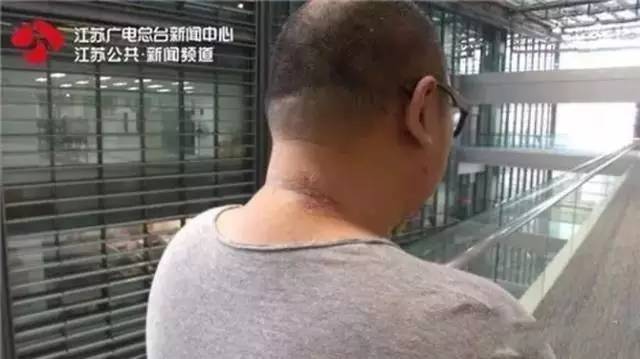 蚊子皮肤细菌感染溃烂,蚊虫叮咬可以拍吗