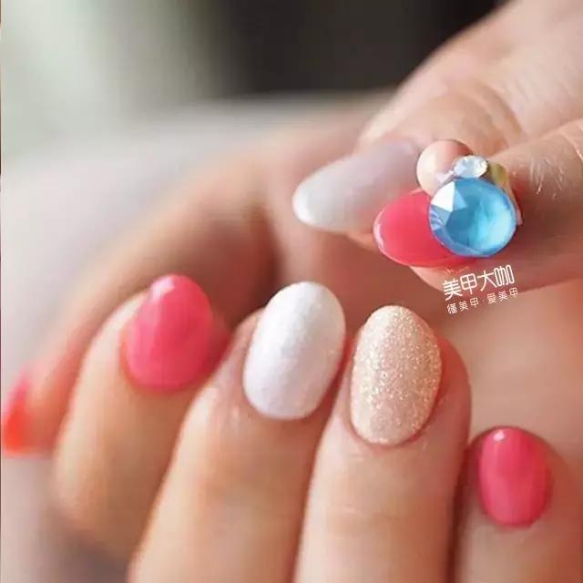 指甲出现白点什么症状,指甲被真菌感染会出现哪些症状