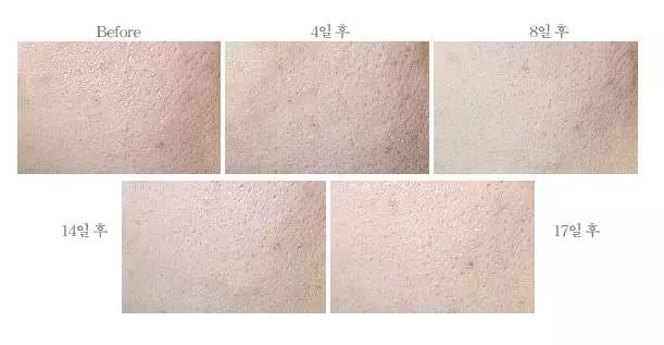 500元以内的护肤品推荐,用100元买一套护肤品