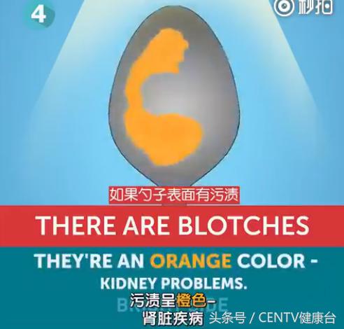 一个勺子,花一分钟知道你身体好不好