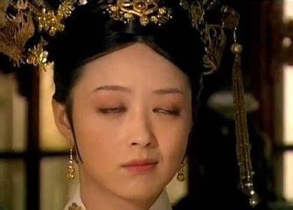 全切双眼皮增生不对称变丑,割完双眼皮为啥会变内双