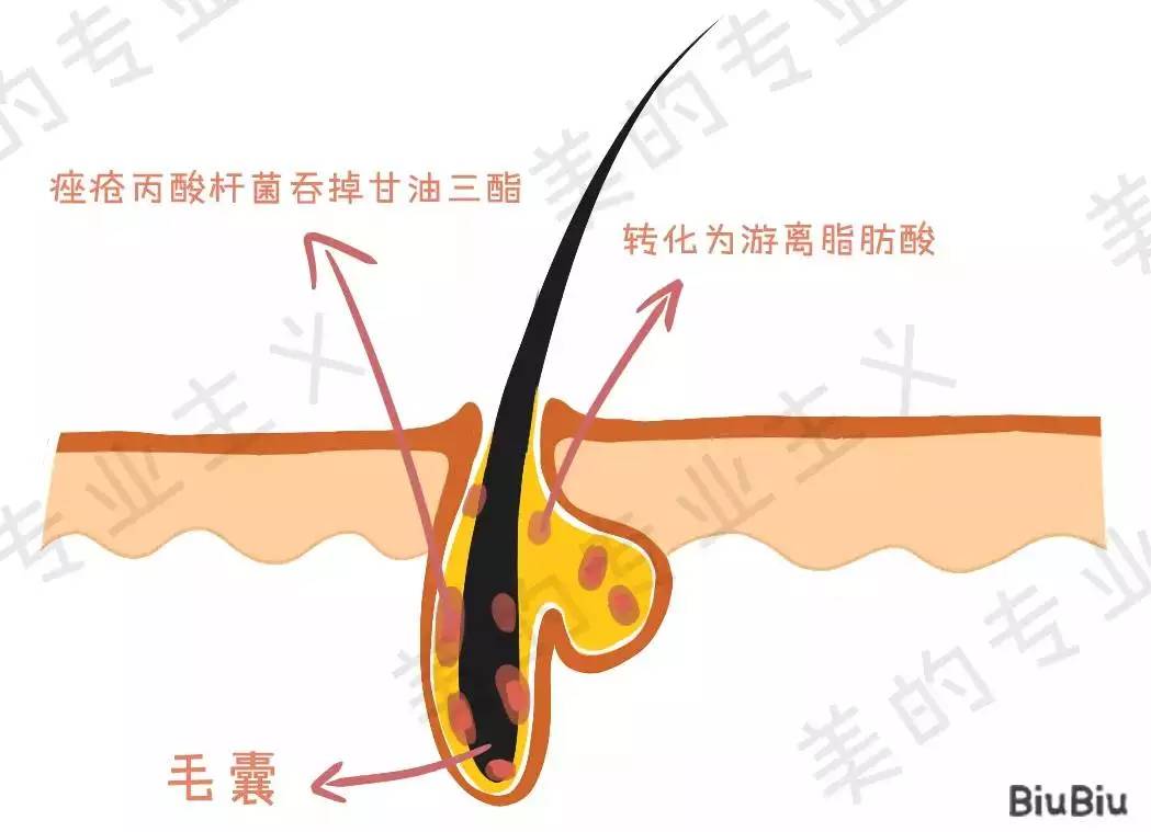 大美人祛斑美白,大美人祛痘
