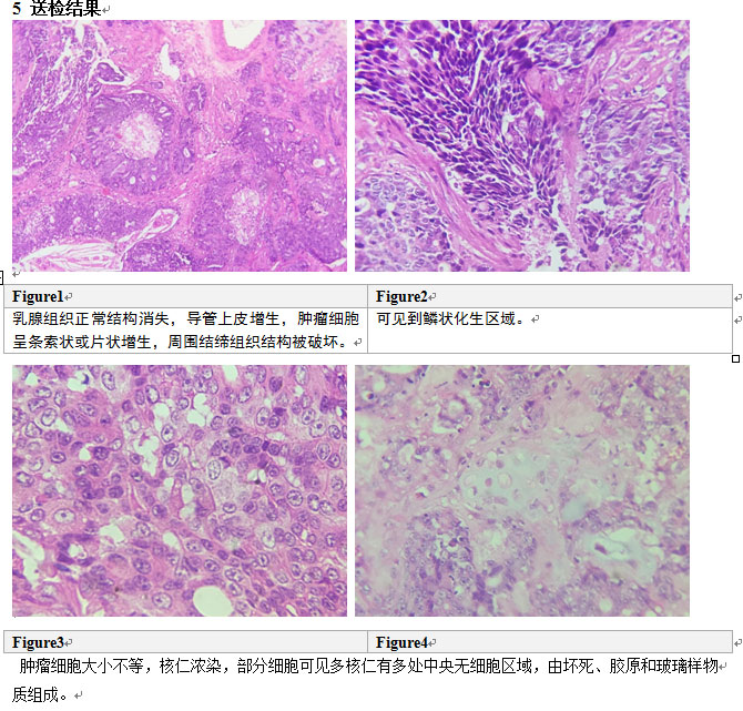 母猫乳腺肿块怎么治疗好,乳腺肿瘤最新研究结果