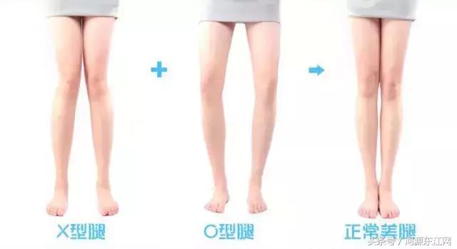 你的双腿合得拢吗?双腿合不拢意味着什么