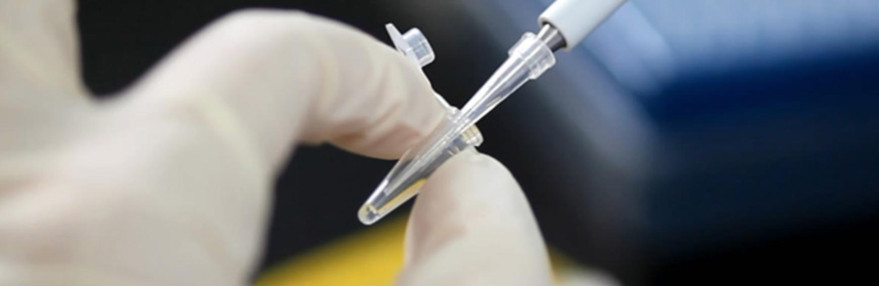 迪安医学检测是正规的检测机构吗,迪安诊断检测