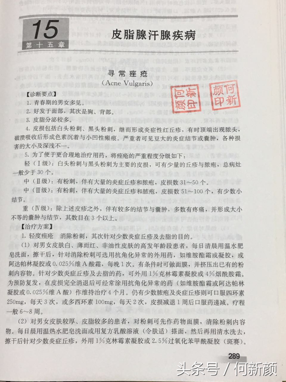 青春痘粉刺黑头怎么样清理效果好,长痘痘粉刺闭口怎么去