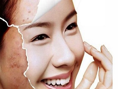 跟着皮肤科专家学习皮肤综合管理方法从此去美容院的钱都省了