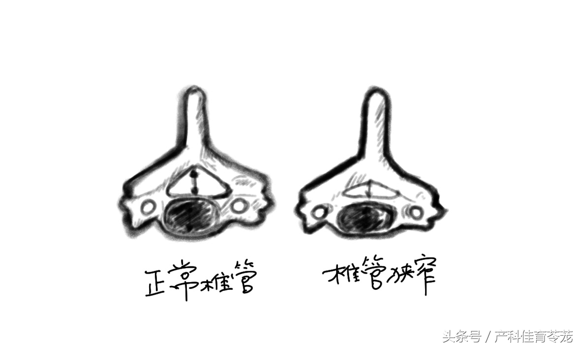 摔了一下颈椎,摔了一下颈椎和肩胛骨