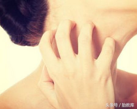 剖宫产刀口痒怎么缓解,剖宫产刀口发痒如何缓解