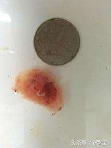 停胎和先兆流产有什么症状,孕早期胎停和正常流产流程一样吗