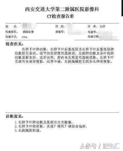 胸痛可能是肺的原因吗,胸痛咯血