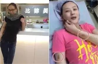 萧淑慎吸毒暴瘦照片,萧淑慎吸毒照片