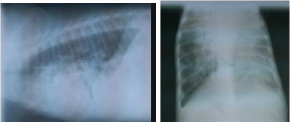 中兽医治疗犬肺水肿,犬肺水肿治疗方法