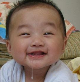 宝宝嘴周围有小红疹子嘴唇有点肿,宝宝嘴周边长小红疙瘩是上火吗