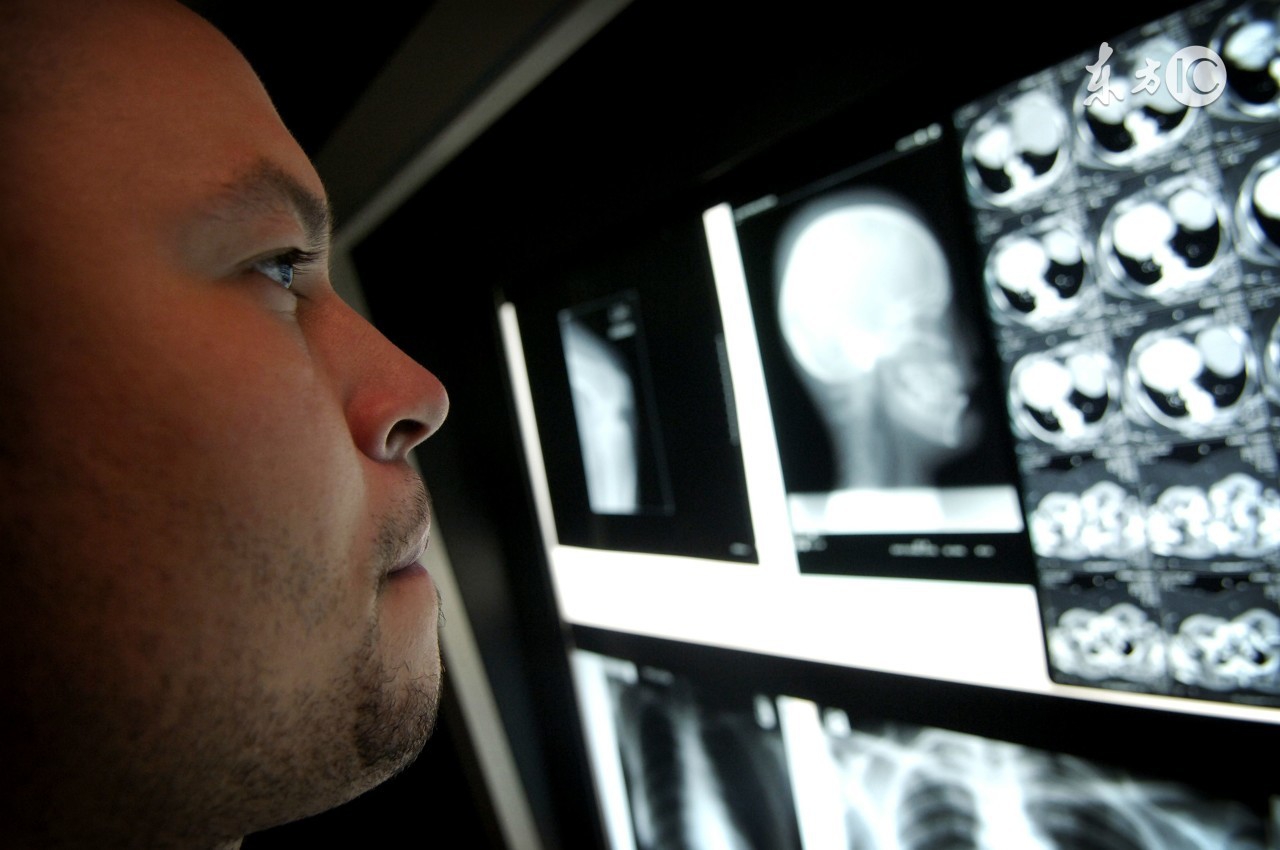 放疗后病人身上有放射性吗