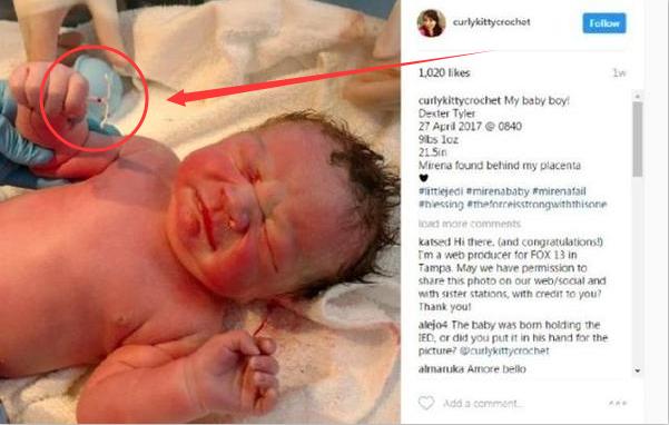 这个宝宝厉害了:想弄死我,没门儿!