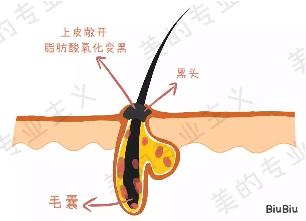 大美人祛斑美白,大美人祛痘