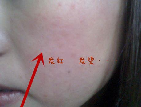 用白醋和蜂蜜洗脸有坏处吗,白醋和盐洗脸有什么好处和坏处