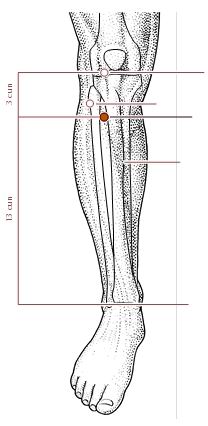 针灸治疗痹症的穴位,痹症的中医针灸治法