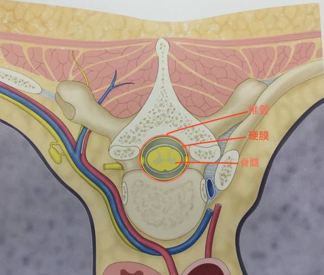 腰腿疼是椎管肿瘤吗,腰腿疼痛需要注意脊髓肿瘤吗