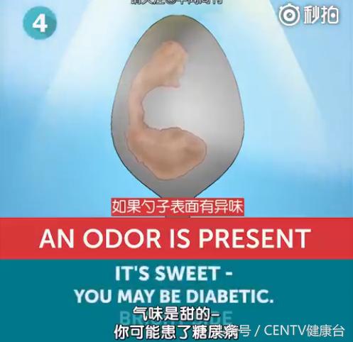 一个勺子,花一分钟知道你身体好不好