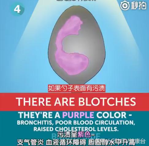 一个勺子,花一分钟知道你身体好不好