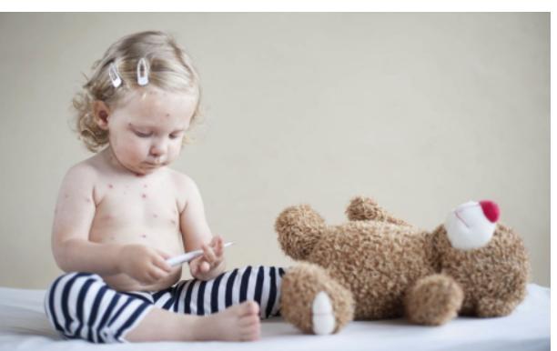 幼儿水痘家长怎么预防,水痘进入高发期谨防水痘侵袭