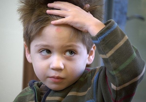 小孩不小心撞到人了怎么处理,小孩子撞到头会发烧吗