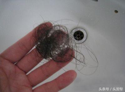 脱发到底都是什么原因,都有哪些原因?你又中招了吗?