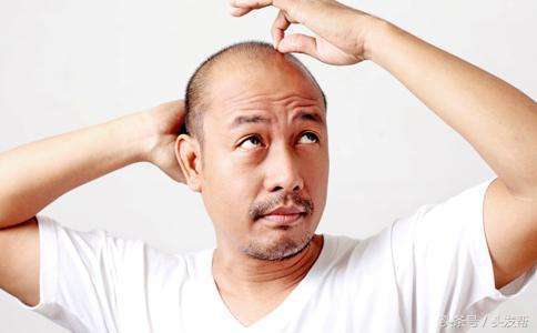 脱发到底都是什么原因,都有哪些原因?你又中招了吗?