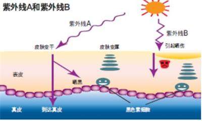 激光祛斑要多久才能完全好,激光脱毛和激光祛斑先做哪个好